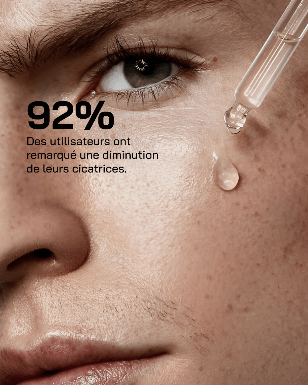 Touché - Sérum Niacinamide 10% + Zinc 1%, 30ml